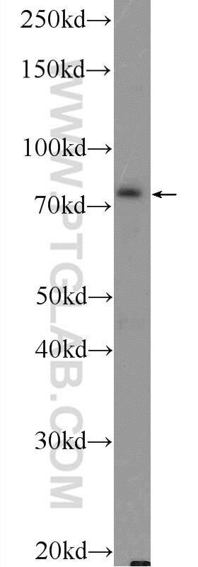 Western Blot (WB) analysis of COLO 320 cells using ASH2L Polyclonal antibody (12331-1-AP)