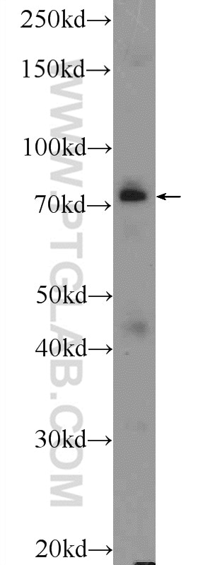 Western Blot (WB) analysis of COLO 320 cells using ASH2L Polyclonal antibody (12331-1-AP)
