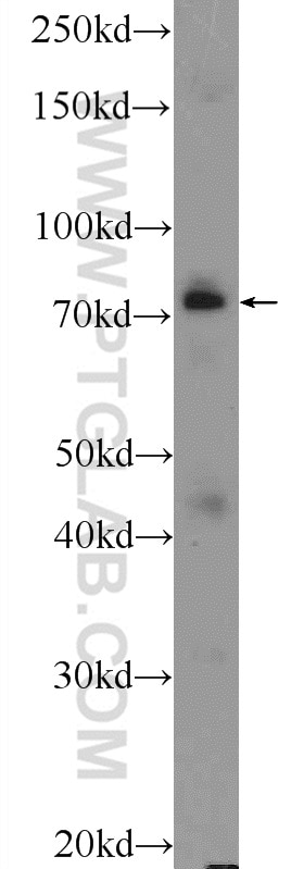 Western Blot (WB) analysis of COLO 320 cells using ASH2L Polyclonal antibody (12331-1-AP)