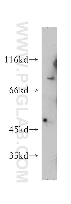 Western Blot (WB) analysis of COS-7 cells using ASH2L Polyclonal antibody (12331-1-AP)