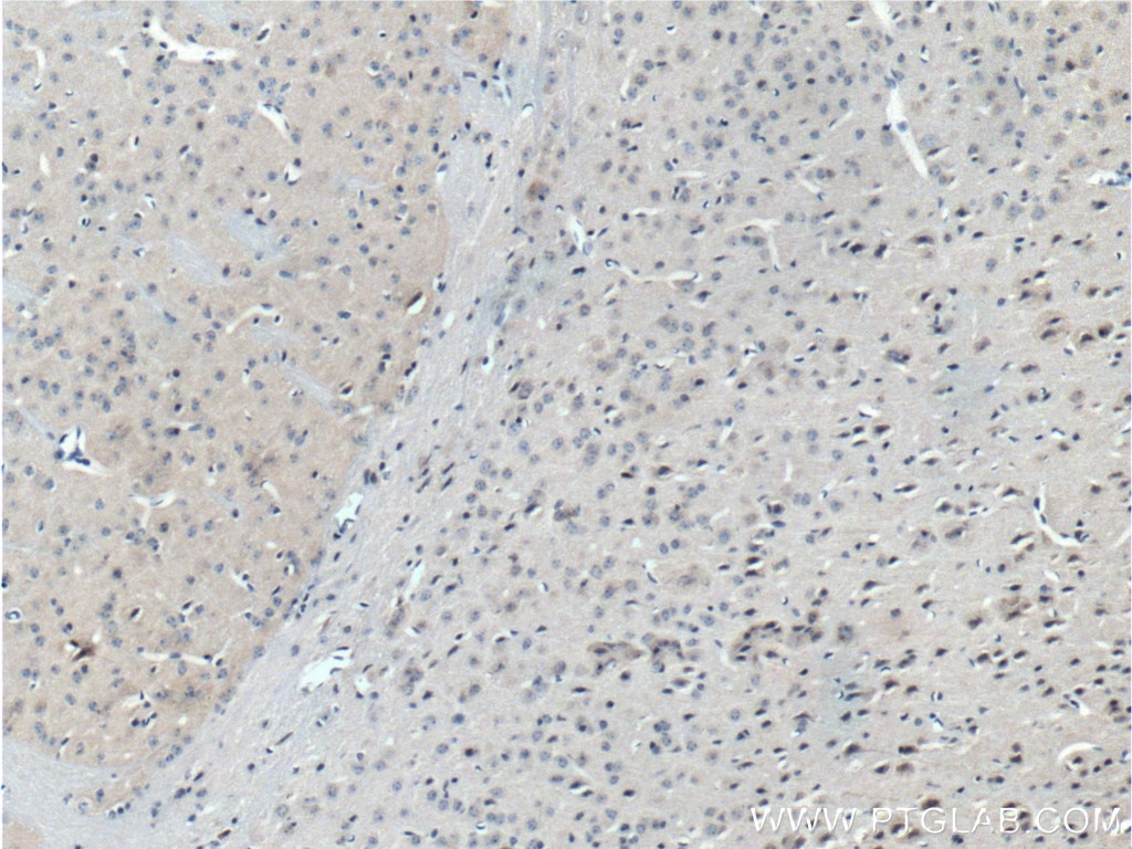 Immunohistochemistry (IHC) staining of mouse brain tissue using ASIC1 Polyclonal antibody (27235-1-AP)