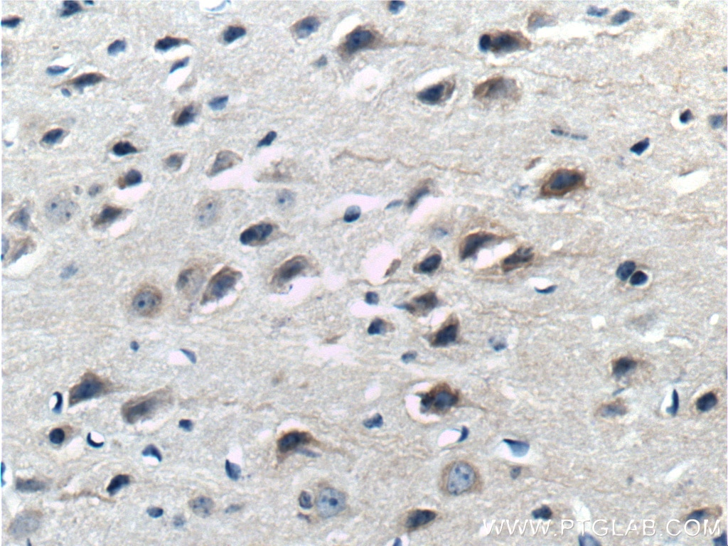 Immunohistochemistry (IHC) staining of mouse brain tissue using ASIC1 Polyclonal antibody (27235-1-AP)