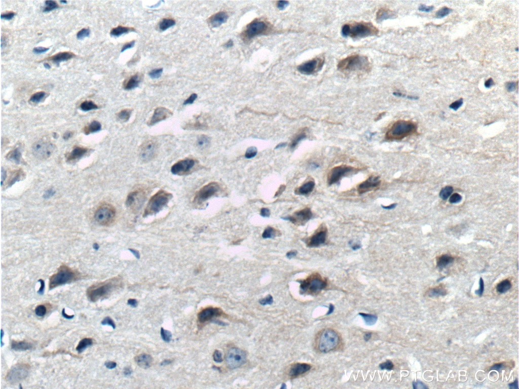 IHC staining of mouse brain using 27235-1-AP