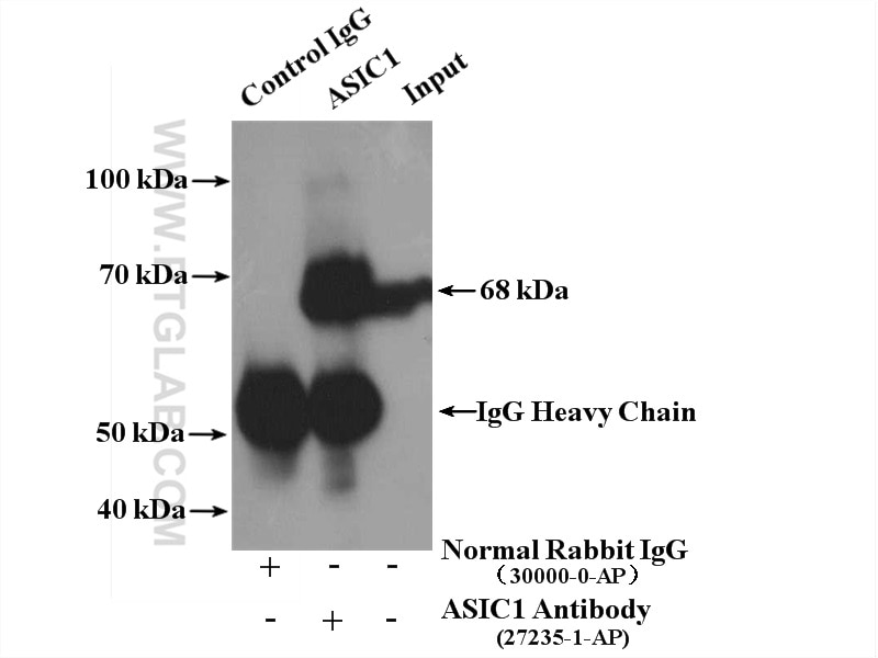Immunoprecipitation (IP) experiment of mouse brain tissue using ASIC1 Polyclonal antibody (27235-1-AP)