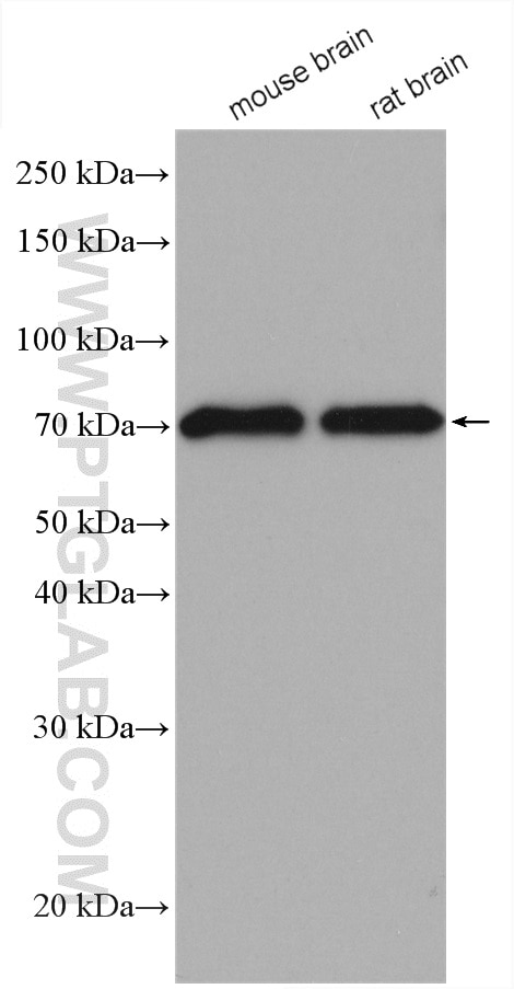 Western Blot (WB) analysis of various lysates using ASIC1 Polyclonal antibody (27235-1-AP)