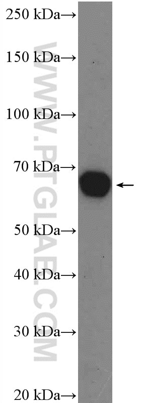 Western Blot (WB) analysis of mouse cerebellum tissue using ASIC1 Polyclonal antibody (27235-1-AP)