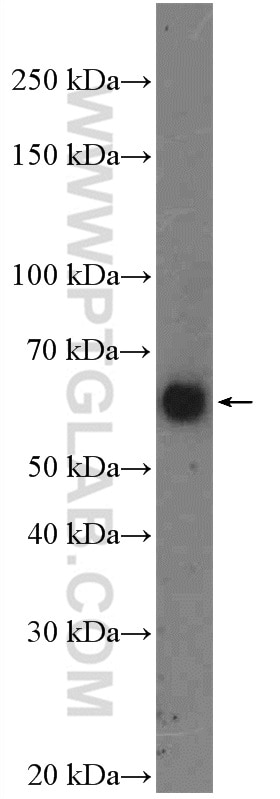 Western Blot (WB) analysis of mouse brain tissue using ASIC1 Polyclonal antibody (27235-1-AP)