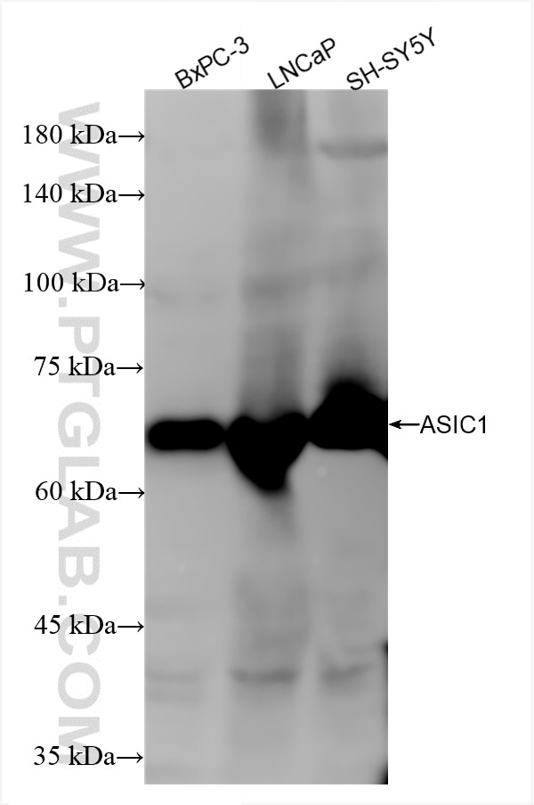 Western Blot (WB) analysis of various lysates using ASIC1 Recombinant antibody (85089-1-RR)