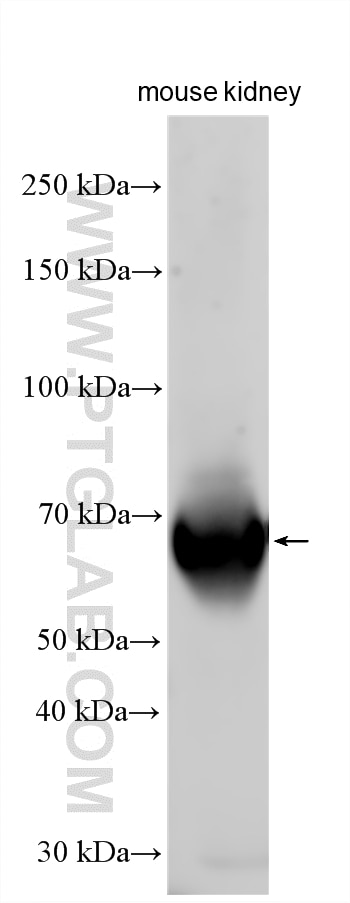Western Blot (WB) analysis of various lysates using ASIC3 Polyclonal antibody (28093-1-AP)