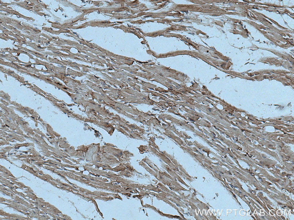 Immunohistochemistry (IHC) staining of mouse heart tissue using ASK1 Polyclonal antibody (28201-1-AP)