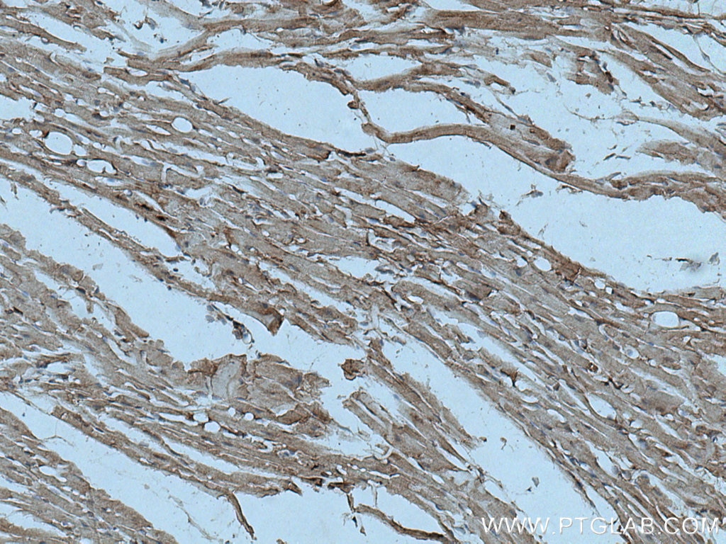 IHC staining of mouse heart using 28201-1-AP