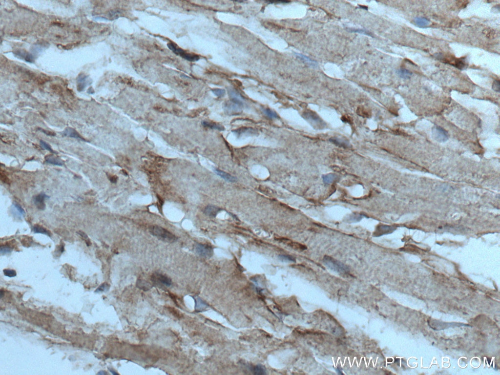 Immunohistochemistry (IHC) staining of mouse heart tissue using ASK1 Polyclonal antibody (28201-1-AP)