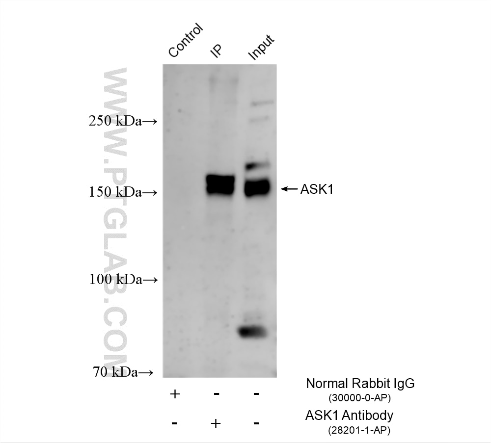 IP result of anti-ASK1 (IP:28201-1-AP, 4ug; Detection:28201-1-AP 1:1000) with HeLa cells lysate 1280 ug. Immunoprecipitation (IP) experiment of HeLa cells using ASK1 Polyclonal antibody (28201-1-AP)