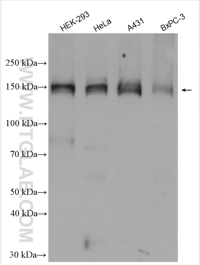 Western Blot (WB) analysis of various lysates using ASK1 Polyclonal antibody (28201-1-AP)