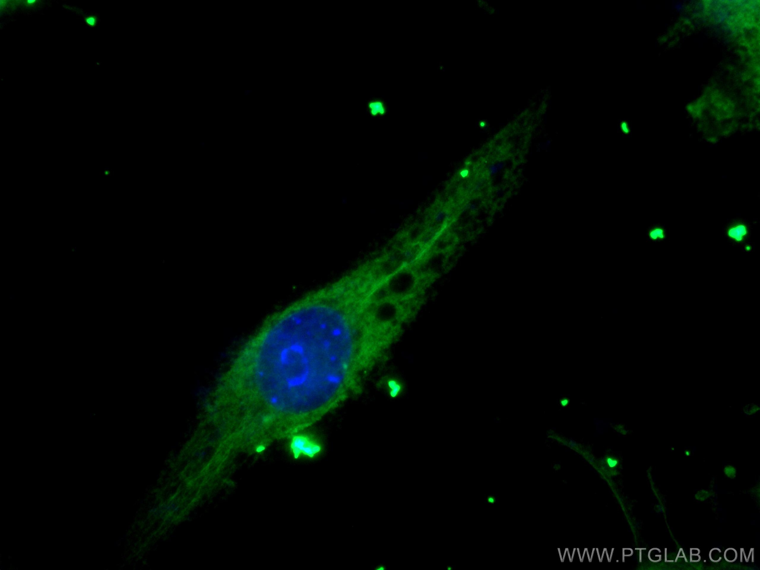 Immunofluorescence (IF) / fluorescent staining of RAW 264.7 cells using ASK1 Monoclonal antibody (67072-1-Ig)