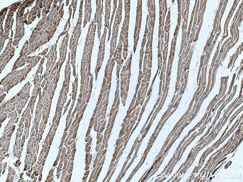 Immunohistochemistry (IHC) staining of mouse heart tissue using ASK1 Monoclonal antibody (67072-1-Ig)