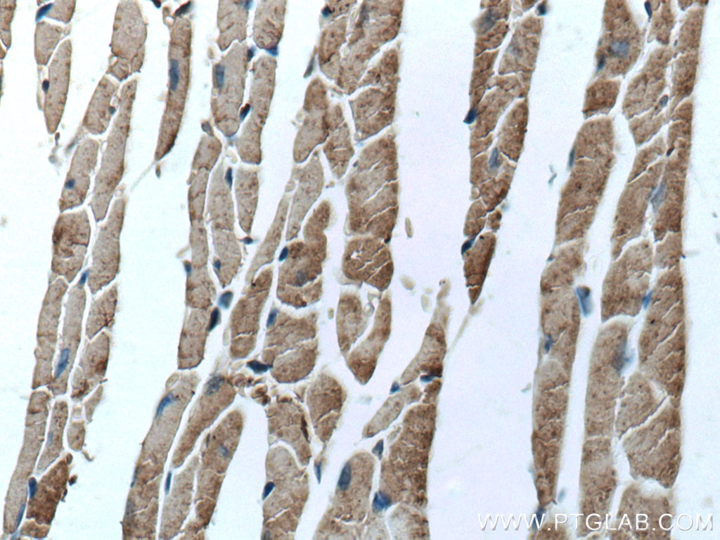 Immunohistochemistry (IHC) staining of mouse heart tissue using ASK1 Monoclonal antibody (67072-1-Ig)