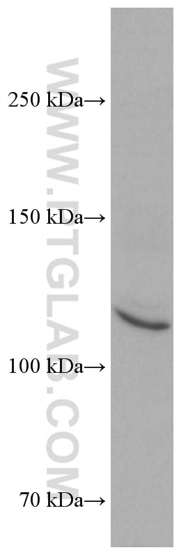Western Blot (WB) analysis of HeLa cells using ASK1 Monoclonal antibody (67072-1-Ig)