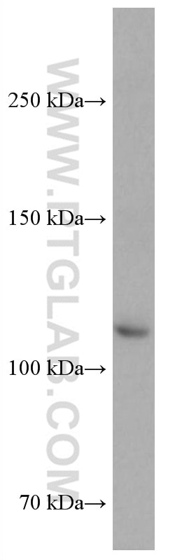 Western Blot (WB) analysis of HEK-293 cells using ASK1 Monoclonal antibody (67072-1-Ig)