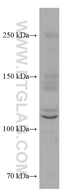 Western Blot (WB) analysis of MCF-7 cells using ASK1 Monoclonal antibody (67072-1-Ig)