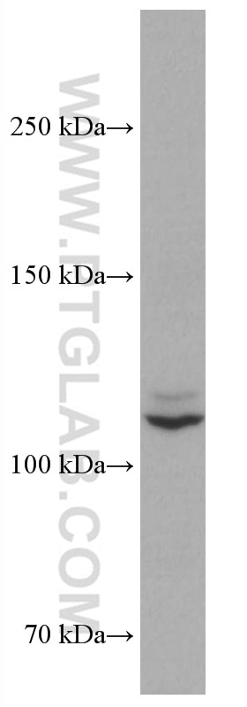 Western Blot (WB) analysis of Jurkat cells using ASK1 Monoclonal antibody (67072-1-Ig)