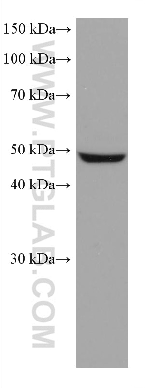 Western Blot (WB) analysis of LNCaP cells using ASL Monoclonal antibody (67692-1-Ig)