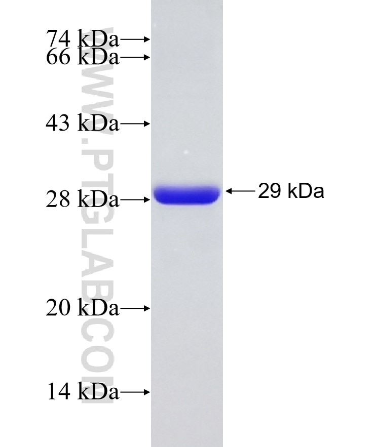 ASMT fusion protein Ag22305 SDS-PAGE