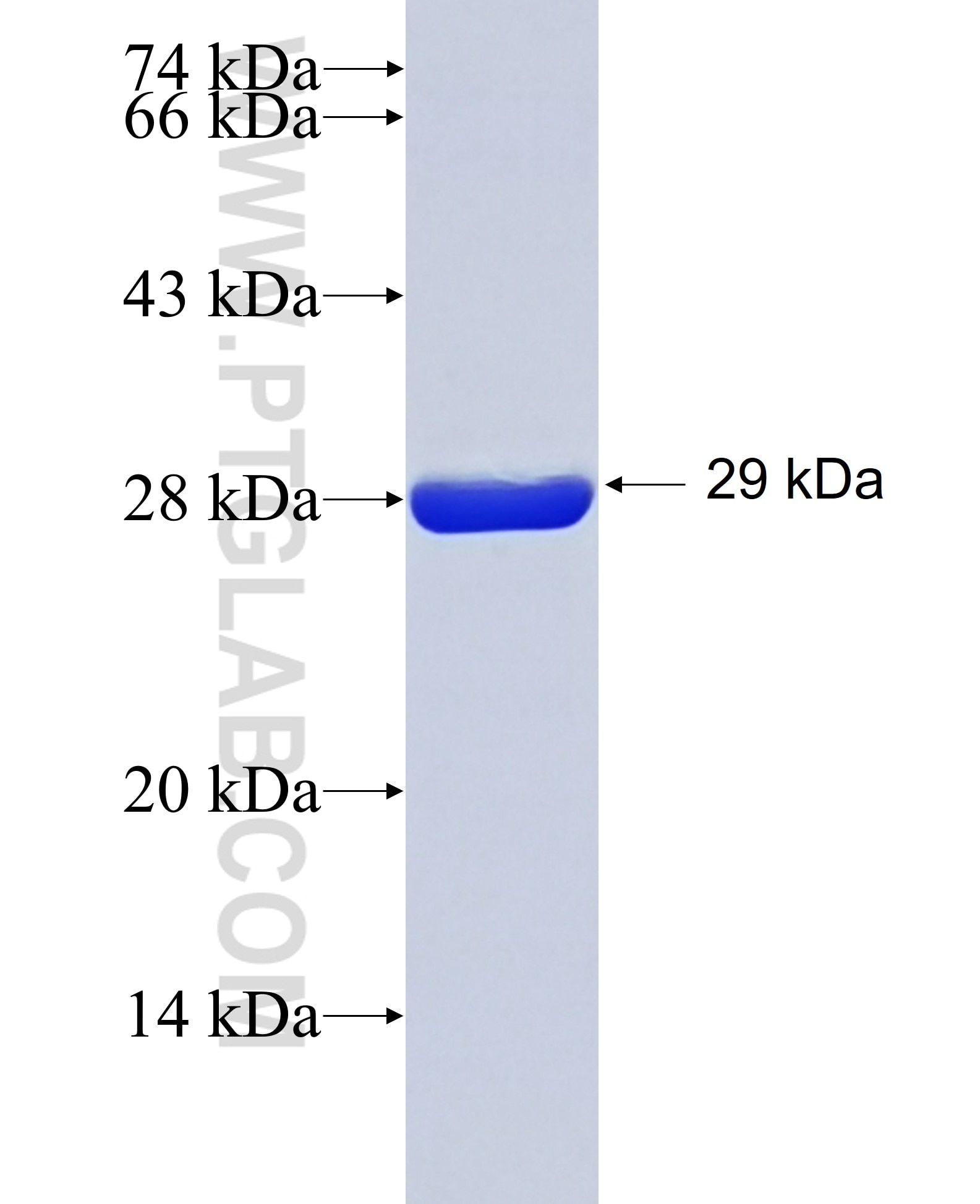 ASMT fusion protein Ag22305 SDS-PAGE