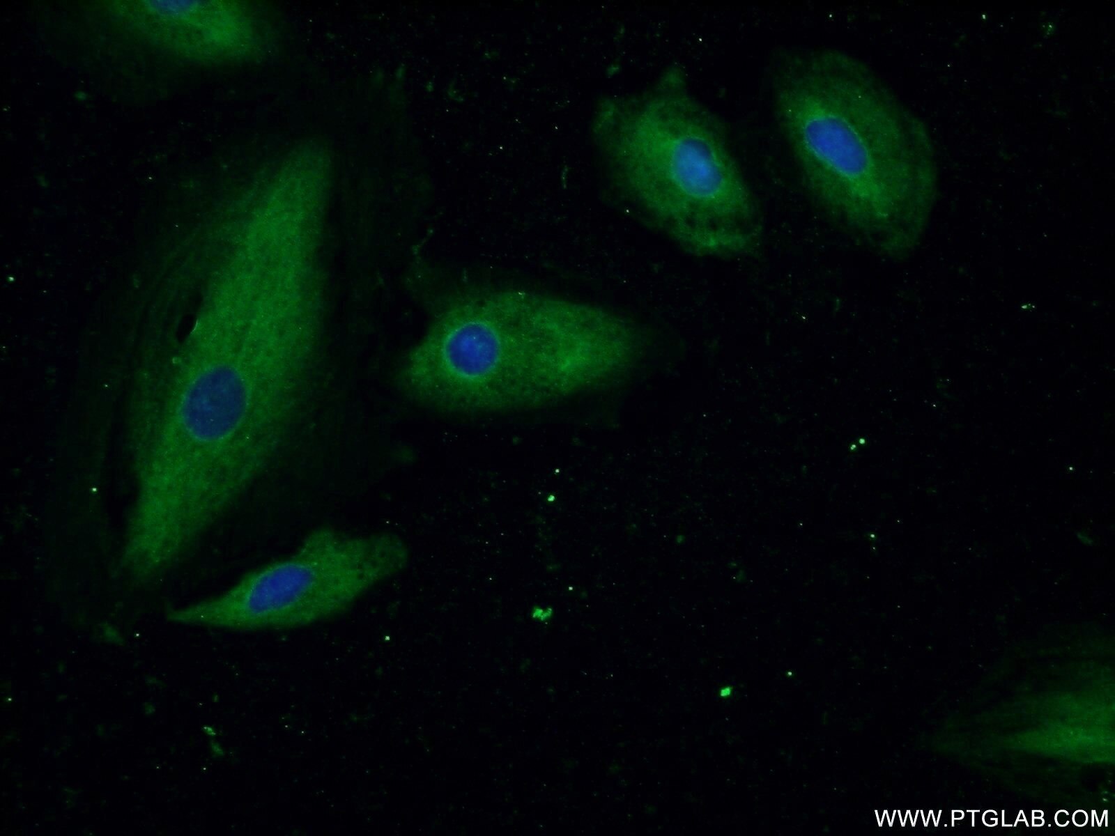 Immunofluorescence (IF) / fluorescent staining of A549 cells using ASMTL Polyclonal antibody (14981-1-AP)