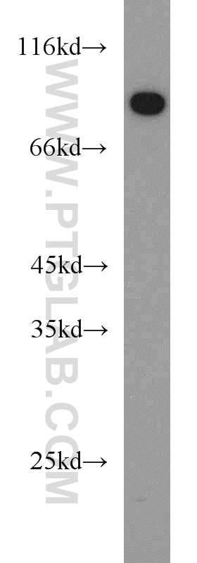 Western Blot (WB) analysis of human testis tissue using ASMTL Polyclonal antibody (14981-1-AP)