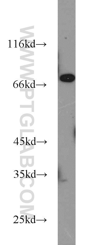 Western Blot (WB) analysis of A549 cells using ASMTL Polyclonal antibody (14981-1-AP)
