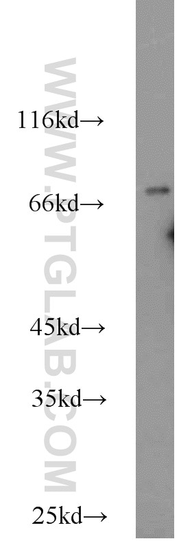 Western Blot (WB) analysis of HeLa cells using ASMTL Polyclonal antibody (14981-1-AP)