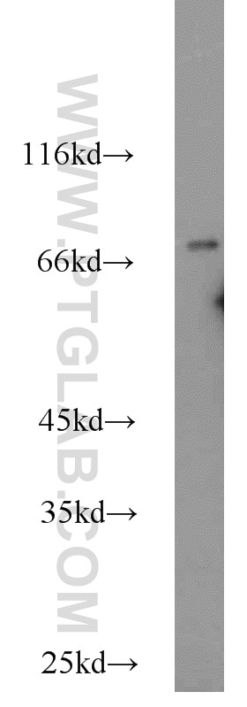 WB analysis of HeLa using 14981-1-AP