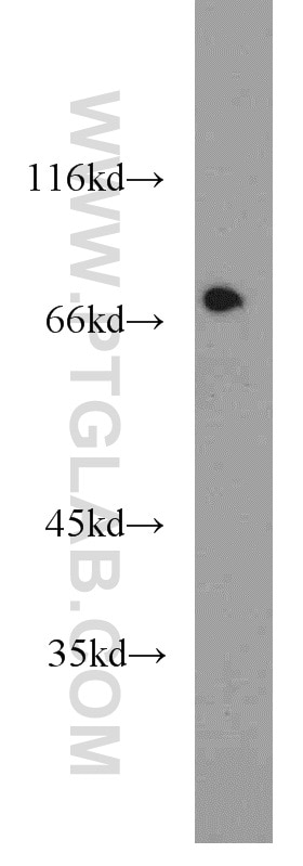 Western Blot (WB) analysis of L02 cells using ASMTL Polyclonal antibody (14981-1-AP)