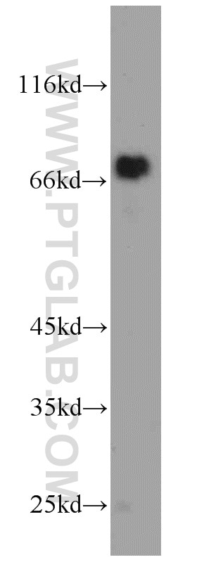 WB analysis of HL-60 using 14981-1-AP