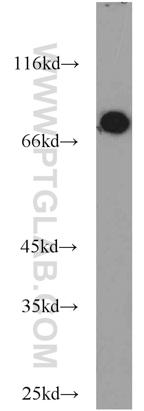 Western Blot (WB) analysis of human testis tissue using ASMTL Polyclonal antibody (14981-1-AP)