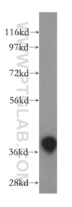 Western Blot (WB) analysis of human brain tissue using ASNA1 Polyclonal antibody (15450-1-AP)