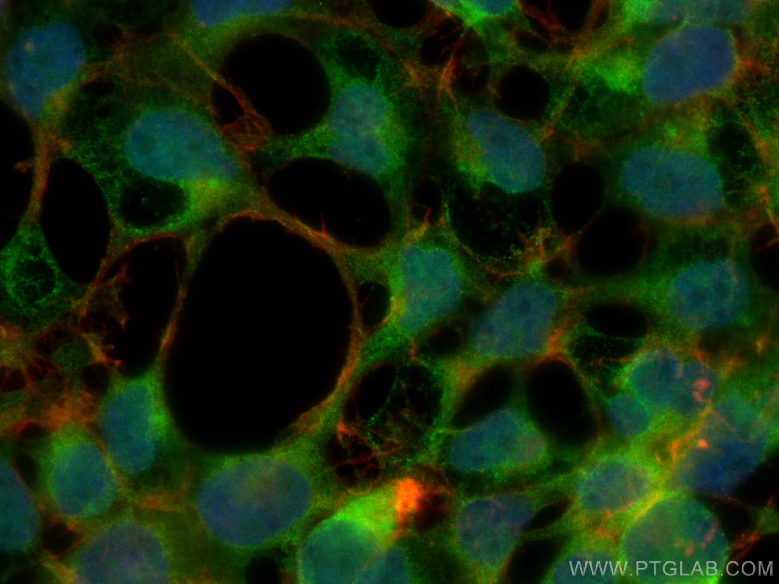 IF Staining of HEK-293 using 66346-1-Ig