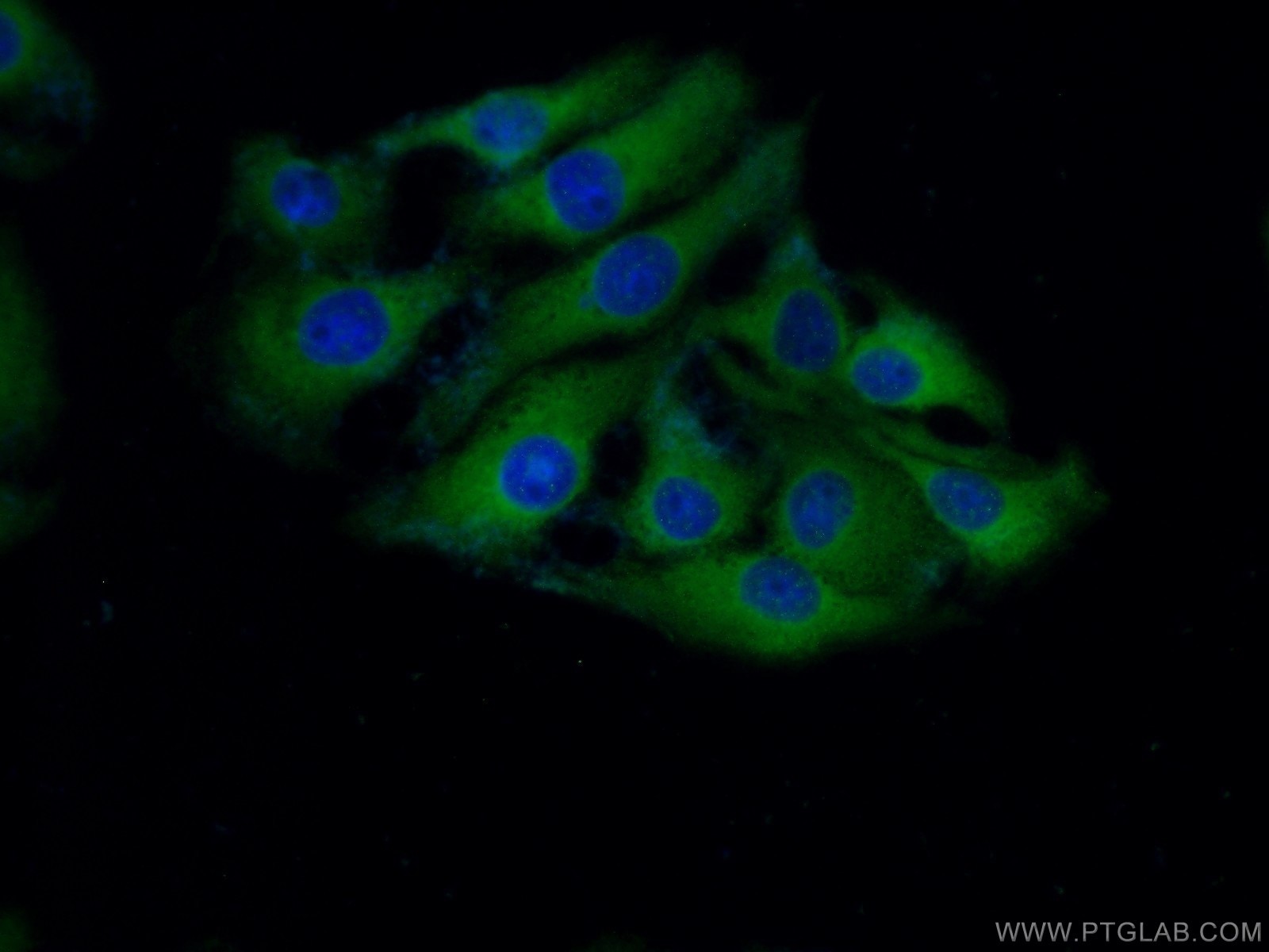 Immunofluorescence (IF) / fluorescent staining of SH-SY5Y cells using ASNS Polyclonal antibody (14681-1-AP)