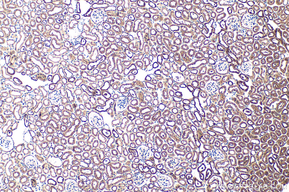 Immunohistochemistry (IHC) staining of mouse kidney tissue using ASNS Polyclonal antibody (14681-1-AP)