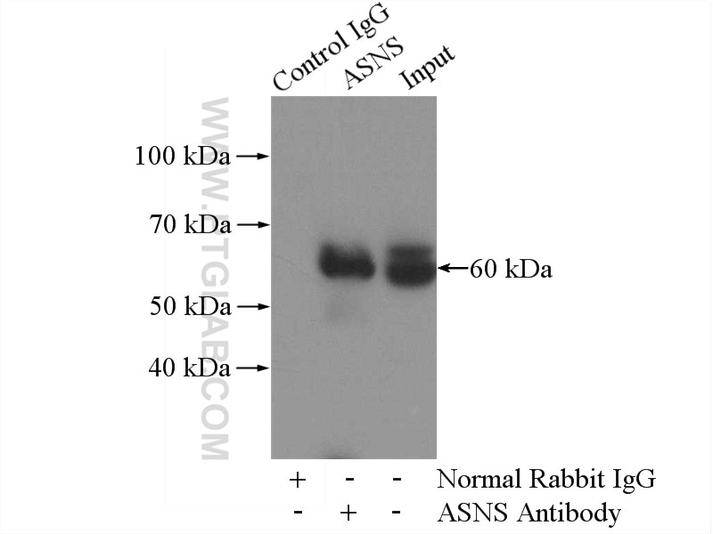 Immunoprecipitation (IP) experiment of HeLa cells using ASNS Polyclonal antibody (14681-1-AP)