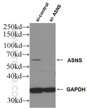 Western Blot (WB) analysis of Jurkat cells using ASNS Polyclonal antibody (14681-1-AP)