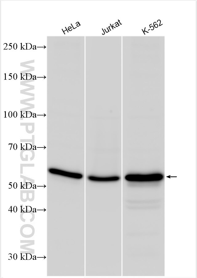 Western Blot (WB) analysis of various lysates using ASNS Polyclonal antibody (14681-1-AP)