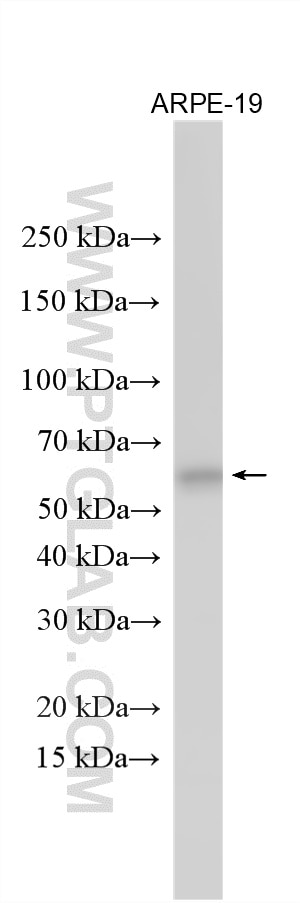 Various lysates were subjected to SDS PAGE followed by western blot with 14681-1-AP (ASNS antibody) at dilution of 1:5000 incubated at room temperature for 1.5 hours. Western Blot (WB) analysis of various lysates using ASNS Polyclonal antibody (14681-1-AP)