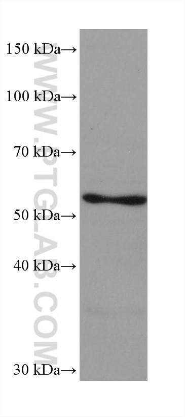 Western Blot (WB) analysis of A431 cells using ASNS Monoclonal antibody (68004-1-Ig)