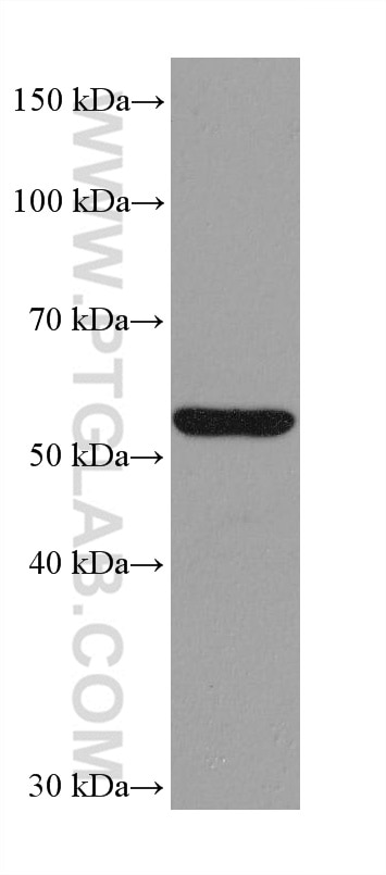 Western Blot (WB) analysis of LNCaP cells using ASNS Monoclonal antibody (68004-1-Ig)