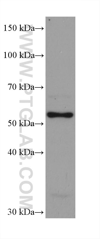 Western Blot (WB) analysis of HeLa cells using ASNS Monoclonal antibody (68004-1-Ig)