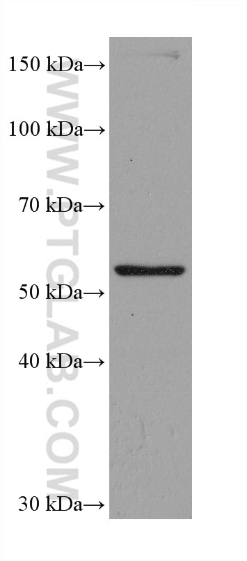 Western Blot (WB) analysis of HEK-293 cells using ASNS Monoclonal antibody (68004-1-Ig)