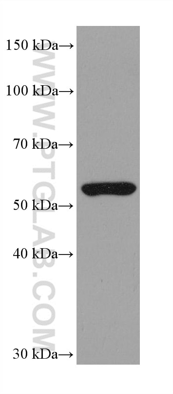 Western Blot (WB) analysis of K-562 cells using ASNS Monoclonal antibody (68004-1-Ig)