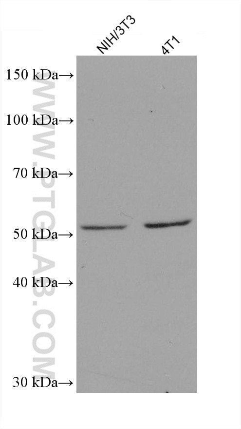 Western Blot (WB) analysis of various lysates using ASNS Monoclonal antibody (68004-1-Ig)